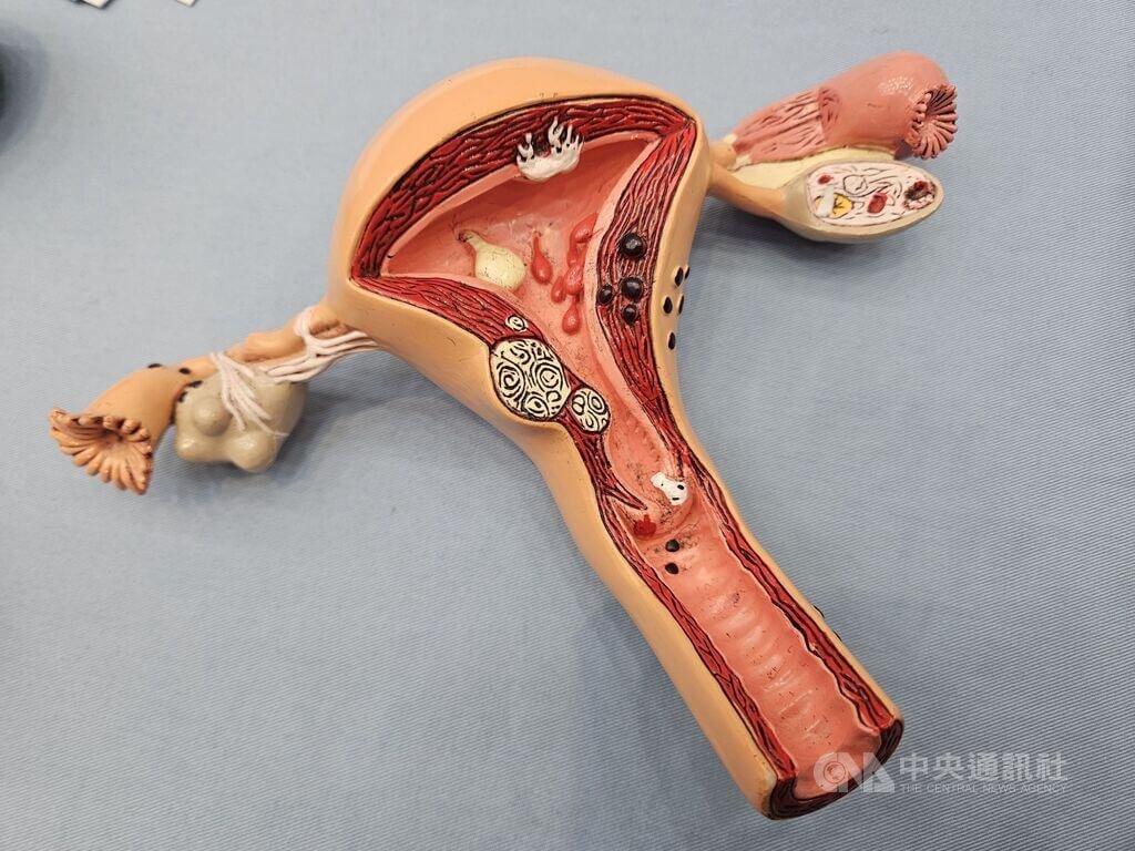 子宮頸抹片下修至25歲！新增3個年齡可免費做HPV檢查