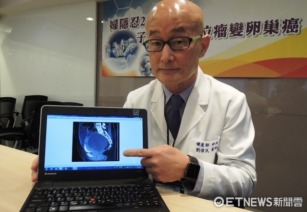 婦產科權威劉偉民爆婚變！嫩妻疑偷吃開房遭拍　醫師無奈發文：明天新聞會嚇到人