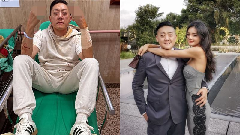 夜店大亨夏天倫遭砍!手臂重傷女友也被波及 他懷疑「與前妻糾紛有關」