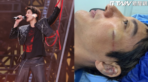 王力宏成都開唱重摔見血！左耳骨碎裂縫27針忍痛上台